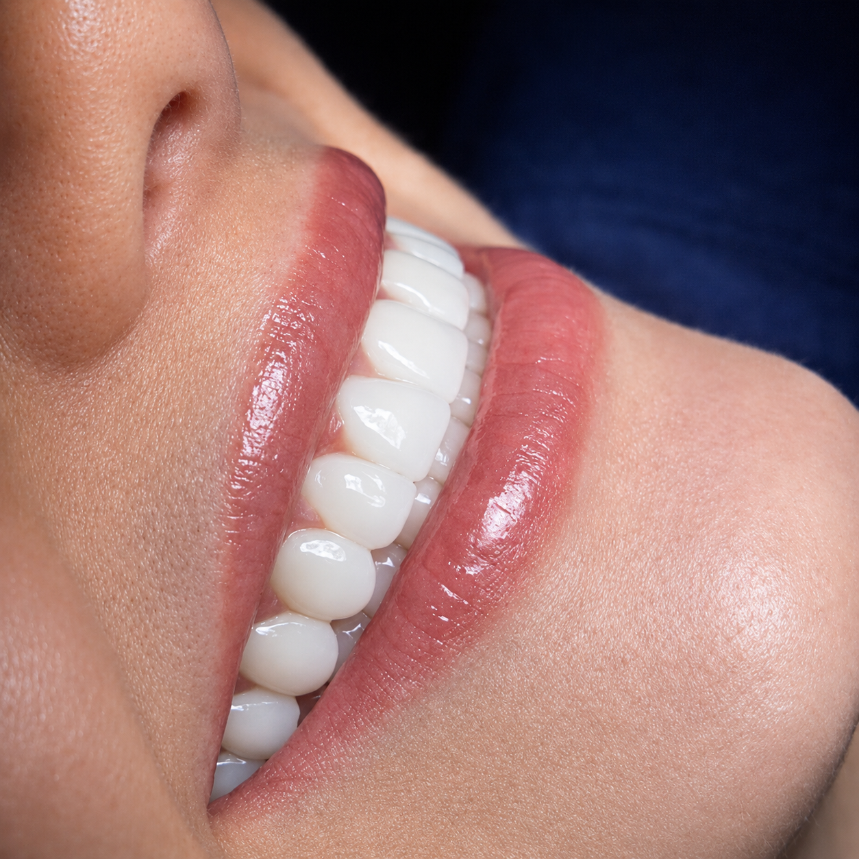 Rehabilitación estética y diseño de sonrisa en Armenia, Quindío, Colombia